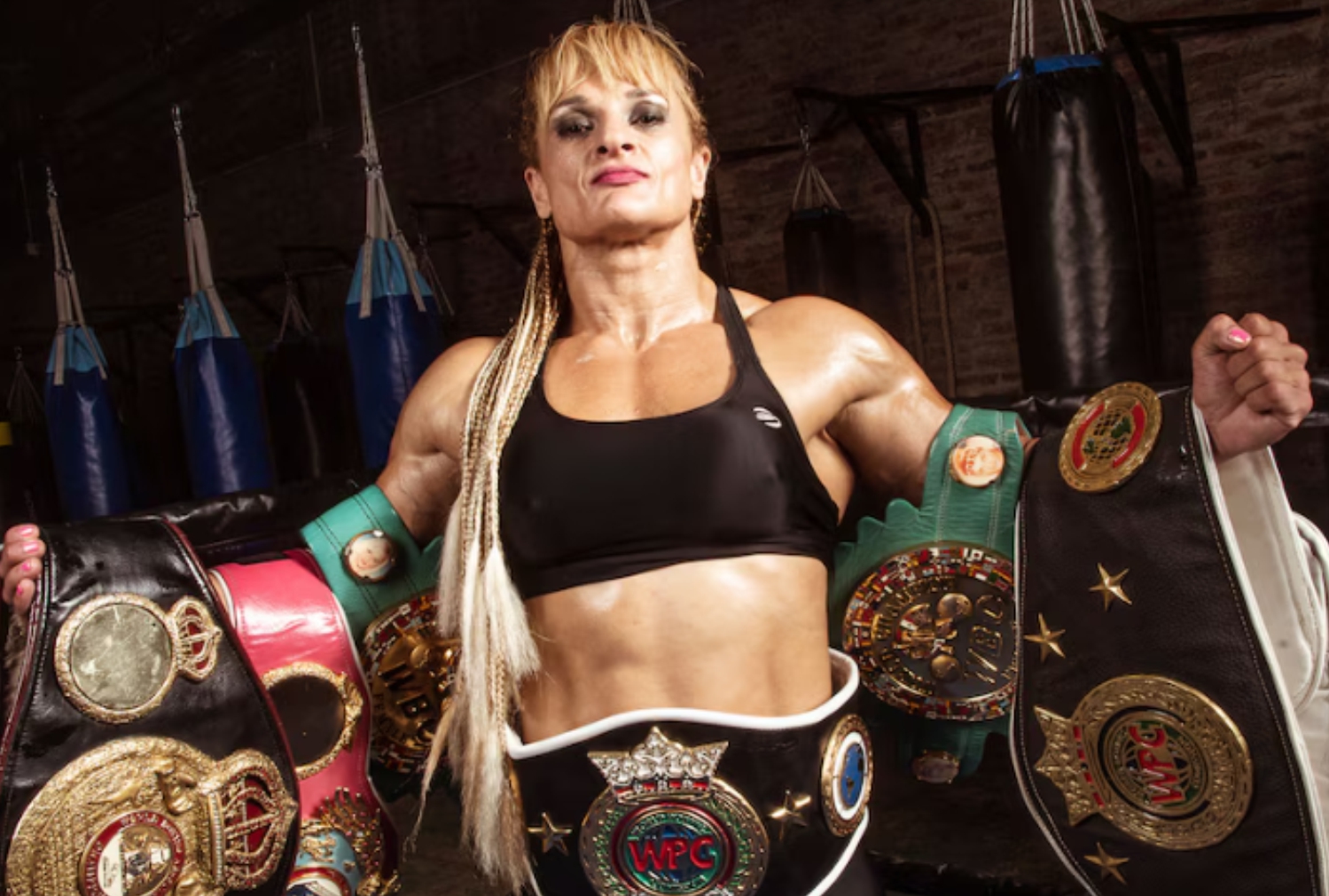 Alejandra “Locomotora” Oliveras fallece tras un complejo ACV isquémico y complicaciones pulmonares
